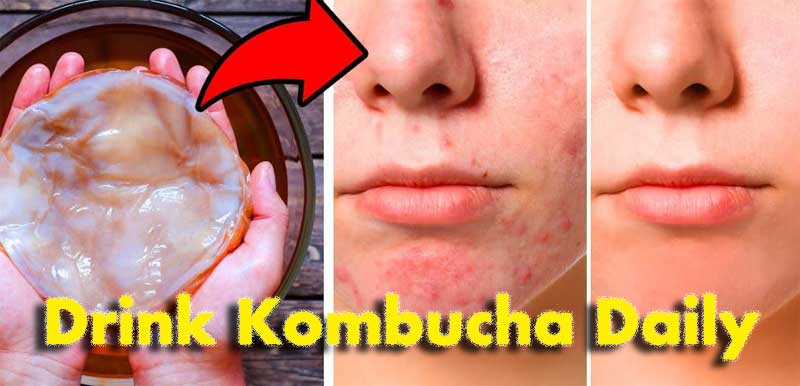 Benefits of Drink Kombucha Daily