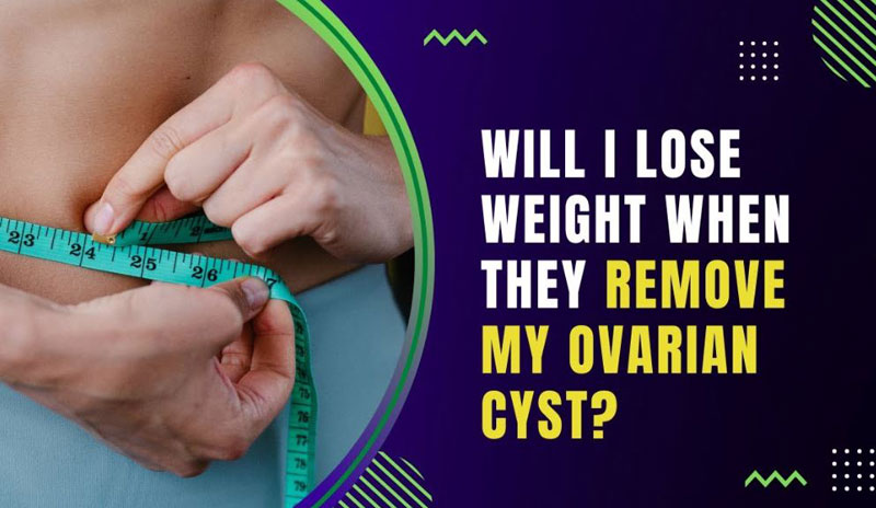 Will I Lose Weight When My Ovarian Cyst Is Removed