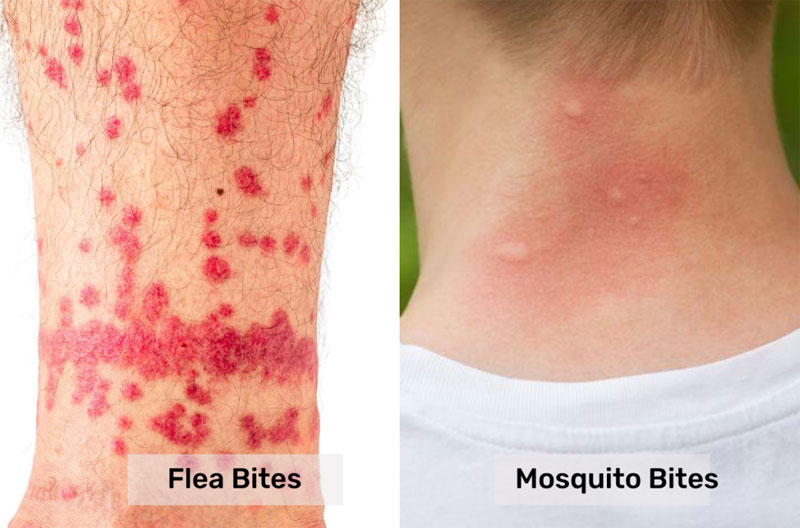 Identifying Flea and Mosquito Bites